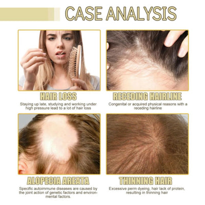 Pella Essence  - Veganes Haaröl für schnelles Wachstum