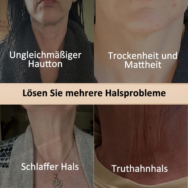 1+1 Gratis | Firmify™ Straffende Hals- und Körpercreme