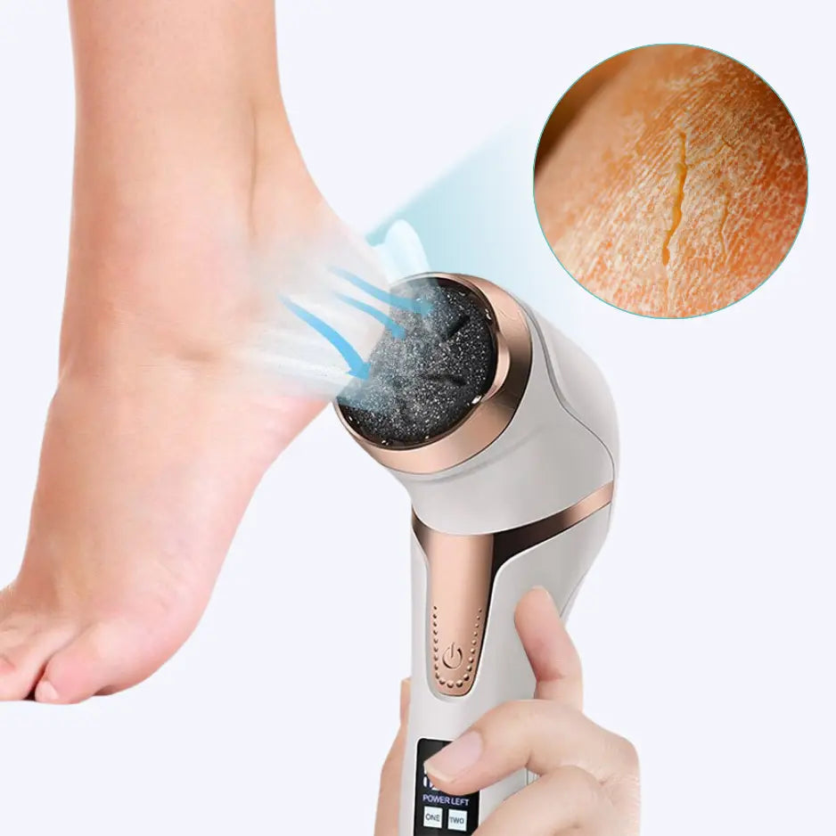 PediPro™ Elektrischer Fußschwielenentferner